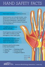 Hand injury prevention